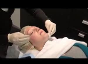getting a cosmetic laser surgery